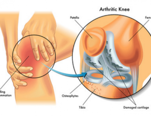 What are the Benefits of Chondroitin Sulfate?